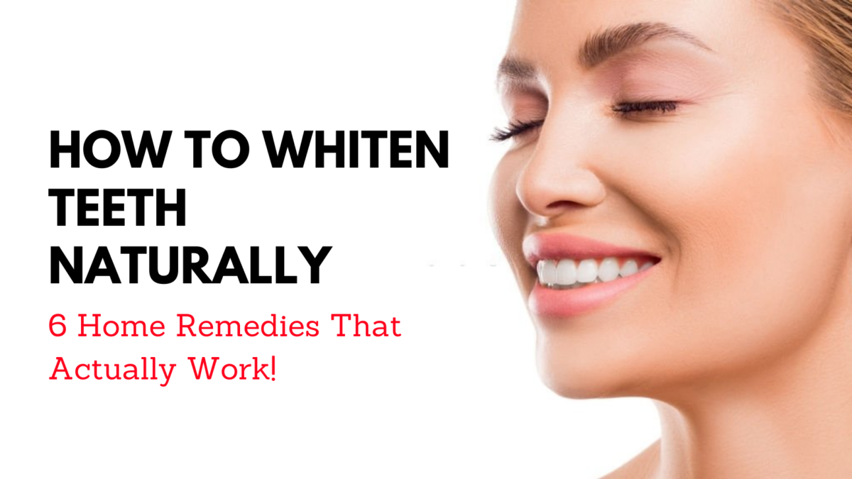 Are There Any Home Remedies That Can Replace Professional Whitening?