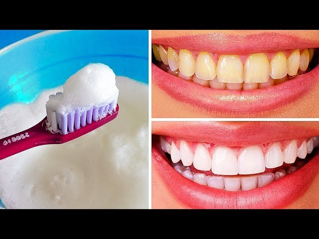 Are There Any Natural Ways To Whiten Teeth?
