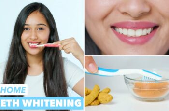 Can I Whiten My Teeth At Home?