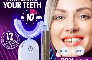 DailySmile Teeth Whitening Kit Review