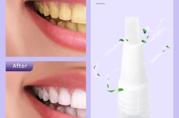 Effective Teeth Whitner Review