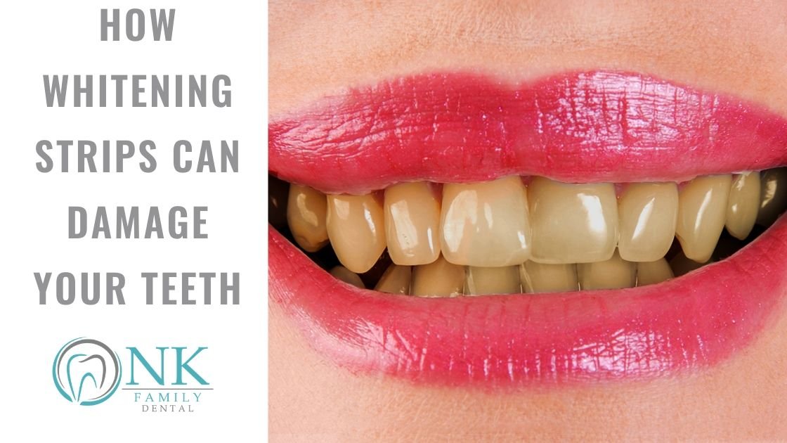 How Does Enamel Affect Teeth Sensitivity During Whitening?