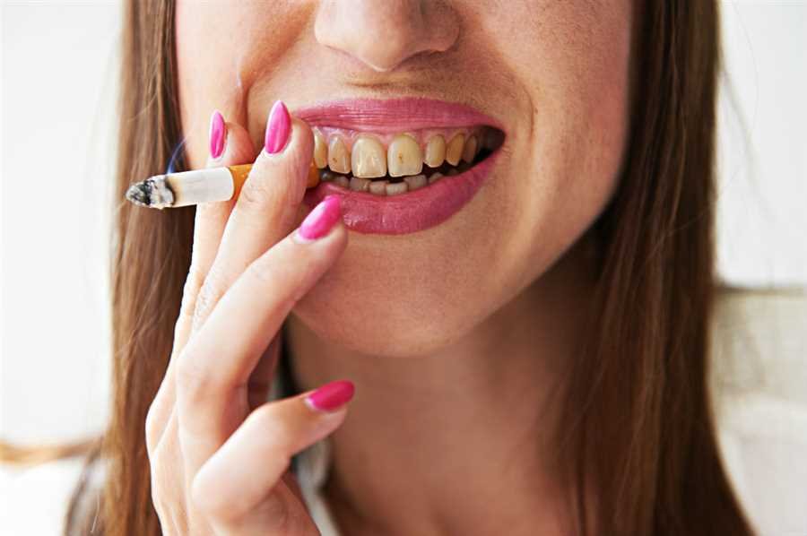 How Does Smoking Impact The Effectiveness Of Teeth Whitening?