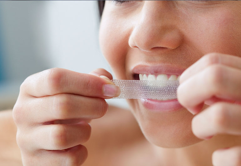 Is Teeth Whitening Safe?