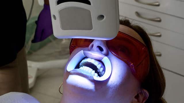 Is UV Light Used In Teeth Whitening Safe?