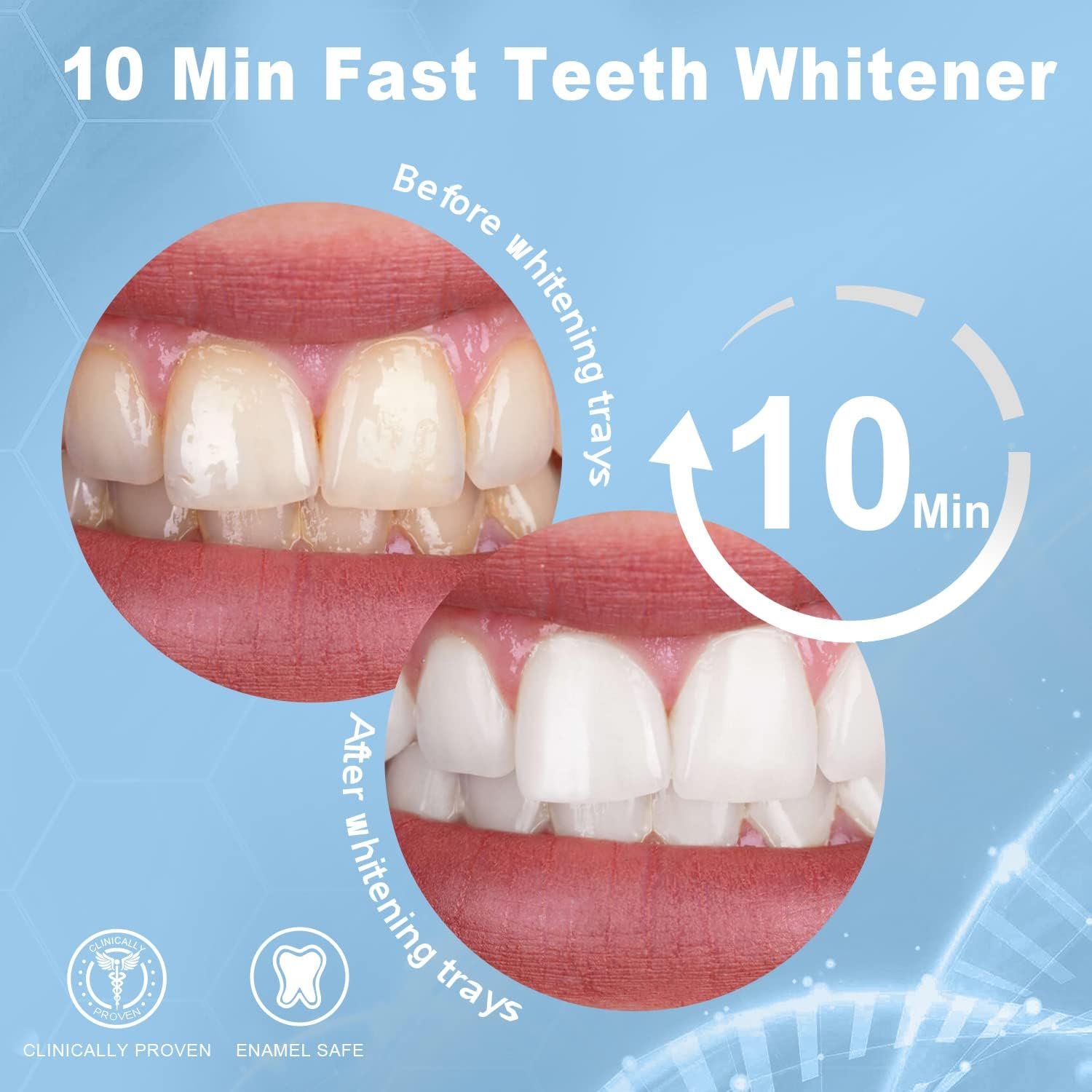 MySmile Teeth Whitening Kit Enhanced Teeth Whitener Flagship Version,10 Min 6 Month Supply, Teeth Whitening Gel Pen Refill Pack, 3 Non-Sensitive Teeth Whitening Pen, 10 Min Fast Whitening Teeth