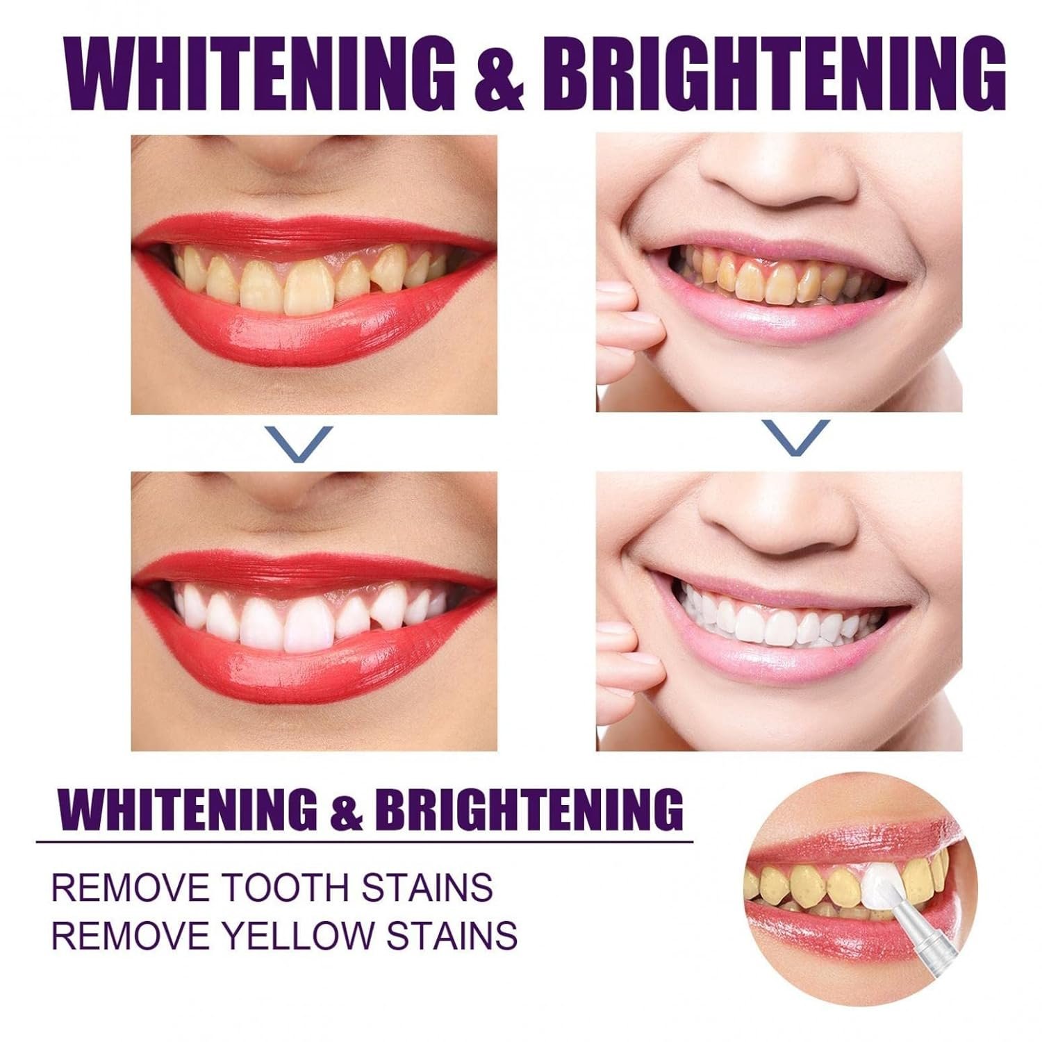 ZITIANY Teeth Whitening Pen, Teeth Stain Remover to Whiten Teeth, Effective＆Painless, No Sensitivity, Travel-Friendly, Easy to Use, Beautiful White Smile, Oral Care, 1PC/4PCS